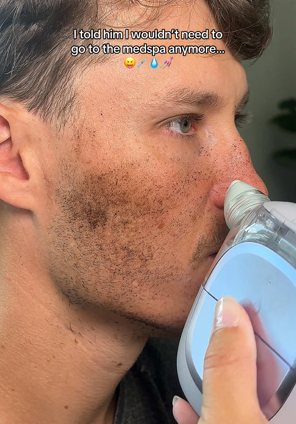 Shark FacialPro Glow At Home Facial System - FH320